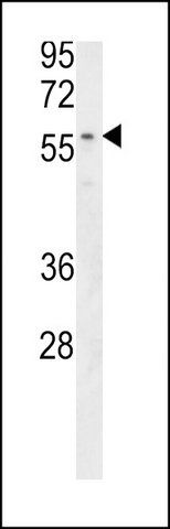 ANTI-MBOAT2 (CENTER) antibody produced in rabbit
