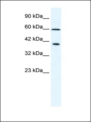 Anti-MCM7 (AB2) antibody produced in rabbit