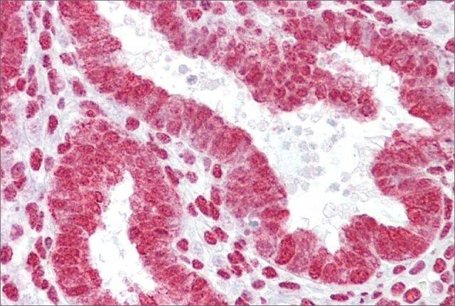 Anti-HOXA11 antibody produced in rabbit