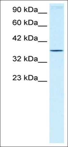 Anti-HOXA7 antibody produced in rabbit