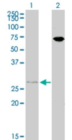 ANTI-HOXB7 antibody produced in mouse
