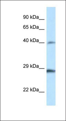 Anti-HOXB9 antibody produced in rabbit