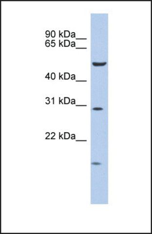 Anti-HOXC5 antibody produced in rabbit