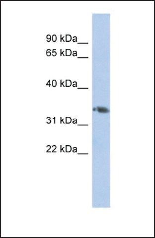 Anti-HOXD10 antibody produced in rabbit