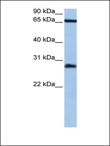 Anti-HOXC6 antibody produced in rabbit