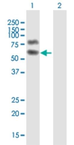 Anti-HP1BP3 antibody produced in mouse