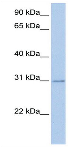 Anti-HOXC11 (AB1) antibody produced in rabbit