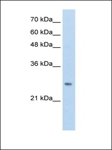 Anti-HOXB7 antibody produced in rabbit