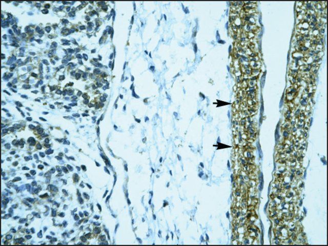 Anti-HOXD12 antibody produced in rabbit