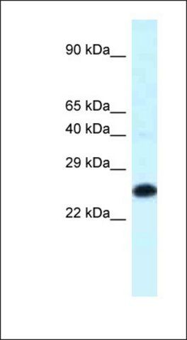 Anti-HOXB9 antibody produced in rabbit