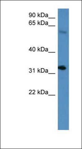 Anti-HOXD13 antibody produced in rabbit