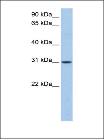 Anti-HUS1B antibody produced in rabbit