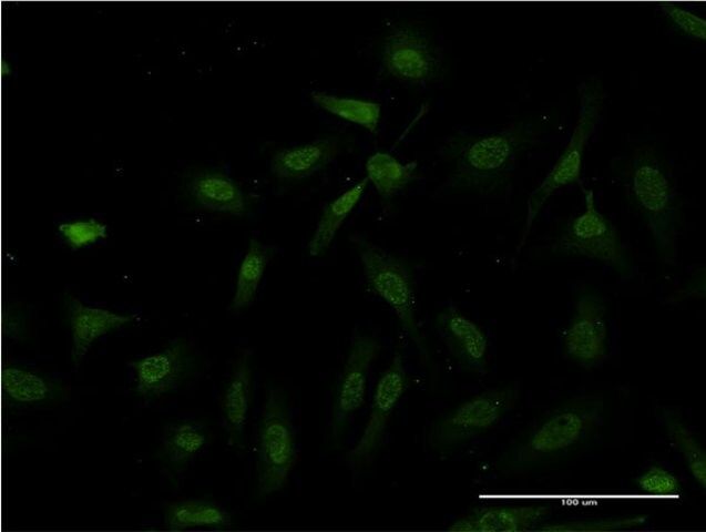 ANTI-IKBKB antibody produced in mouse