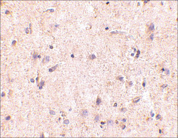 Anti-IRGM (ab2) antibody produced in rabbit
