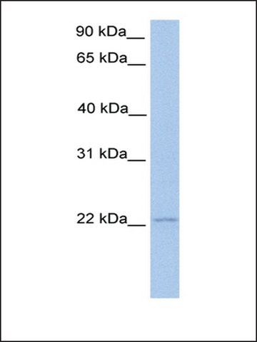 Anti-ISG20 antibody produced in rabbit