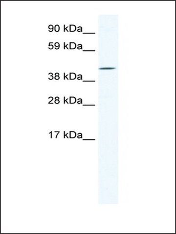 Anti-IRX6 antibody produced in rabbit