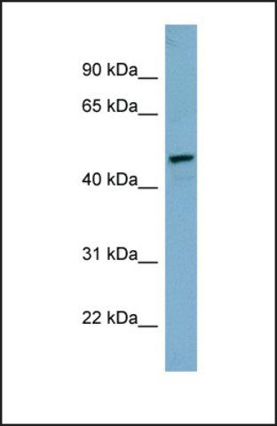 Anti-IRX1 antibody produced in rabbit