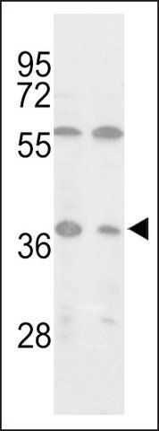 ANTI-ISOCITRATE DEHYDROGENASE (IDH3)(C-TERMINAL) antibody produced in rabbit