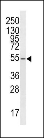 ANTI-JMJD6 (PTDSR) (N-TERM) antibody produced in rabbit