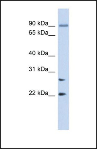 Anti-JOSD2, (N-terminal) antibody produced in rabbit