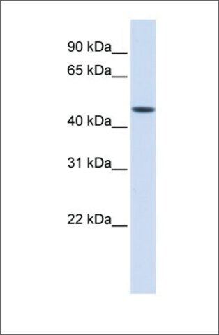 Anti-JMJD5 antibody produced in rabbit