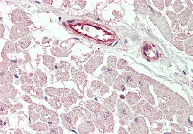 Anti-KCNIP2 (ab1) antibody produced in rabbit