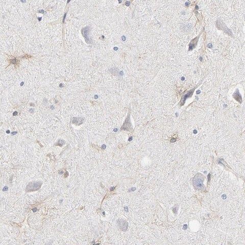 Anti-KCNK13 antibody produced in rabbit