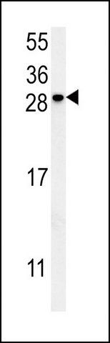 ANTI-KCT2 (CENTER) antibody produced in rabbit