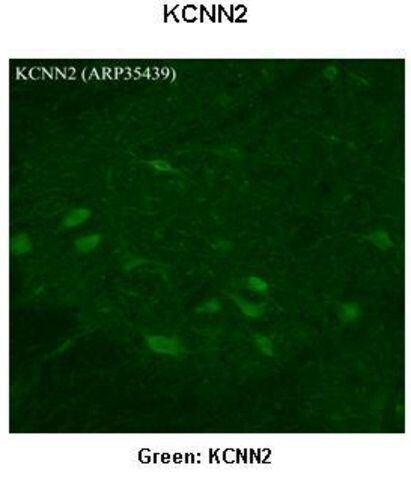Anti-KCNN2 antibody produced in rabbit