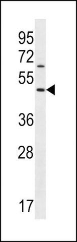 ANTI-KERA (C-TERM) antibody produced in rabbit