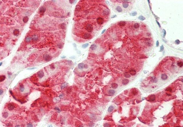 Anti-KHK, (N-terminal) antibody produced in rabbit