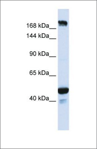 Anti-KIAA1618 (ab1) antibody produced in rabbit