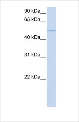 Anti-KIF12 antibody produced in rabbit