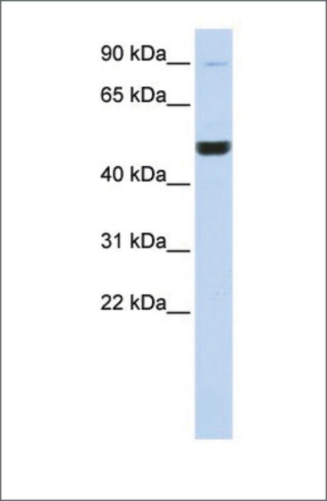 Anti-KIF2A (ab1) antibody produced in rabbit