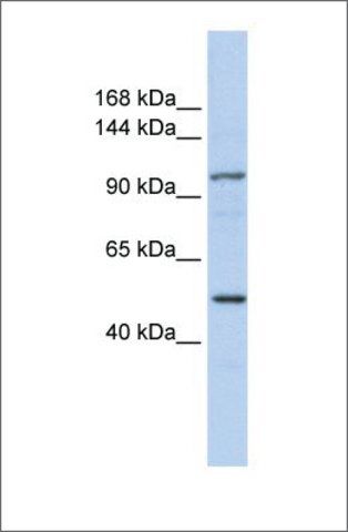 Anti-KIAA1618 (ab2) antibody produced in rabbit