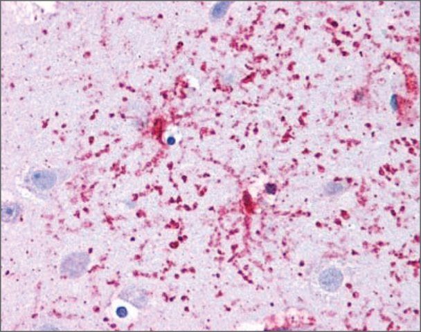 Anti-GLUD1, (N-terminal) antibody produced in rabbit