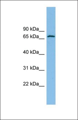 Anti-GLUD2, (N-terminal) antibody produced in rabbit