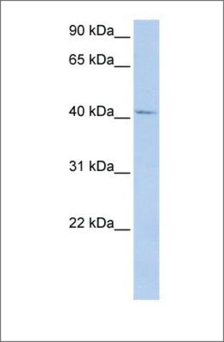 Anti-GTF2H4 antibody produced in rabbit