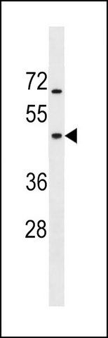 ANTI-GTPBP5 (N-TERM) antibody produced in rabbit