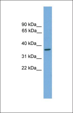 Anti-GTF2H3, (N-terminal) antibody produced in rabbit