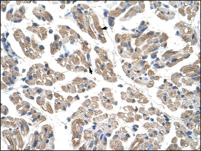 Anti-GTPBP9 (AB1) antibody produced in rabbit