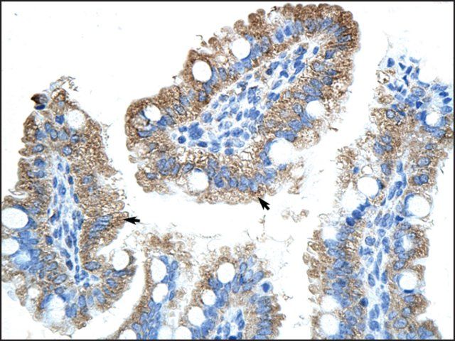 Anti-GTPBP9 (AB2) antibody produced in rabbit