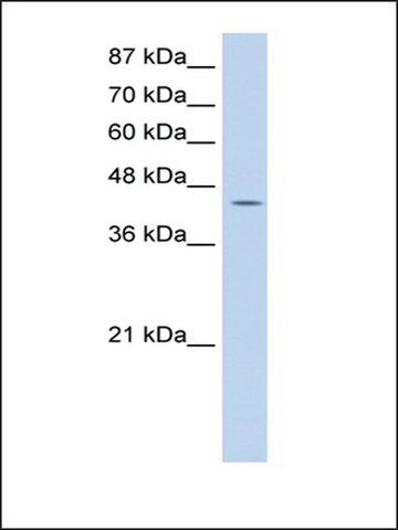 Anti-GTPBP9 (AB1) antibody produced in rabbit