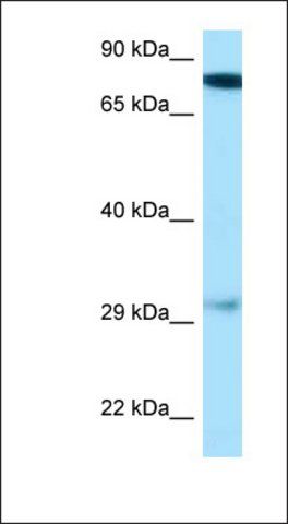 Anti-GUCY1B3 antibody produced in rabbit