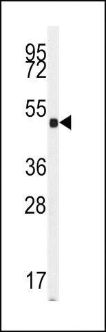 ANTI-GUANYLYL CYCLASE ALPHA 2 (GUCY1A2)(N-TERMINAL) antibody produced in rabbit