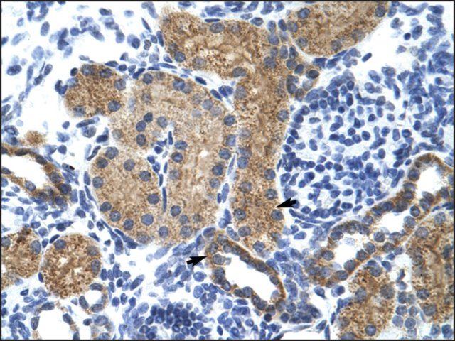 Anti-GTF3C5 (AB1) antibody produced in rabbit