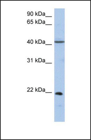 Anti-GUK1 antibody produced in rabbit
