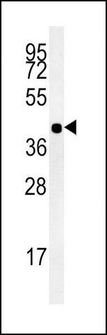ANTI-HCG_1745121 (C-TERM) antibody produced in rabbit