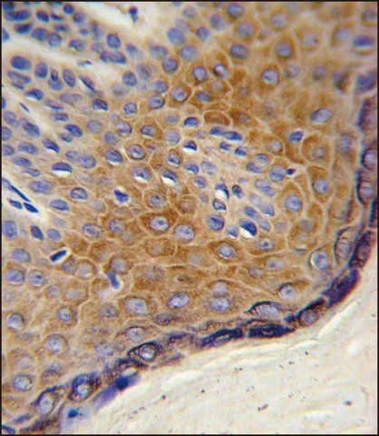ANTI-DERA (N-TERM) antibody produced in rabbit