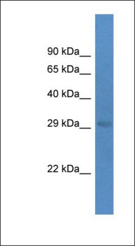 Anti-eIF4E antibody produced in rabbit